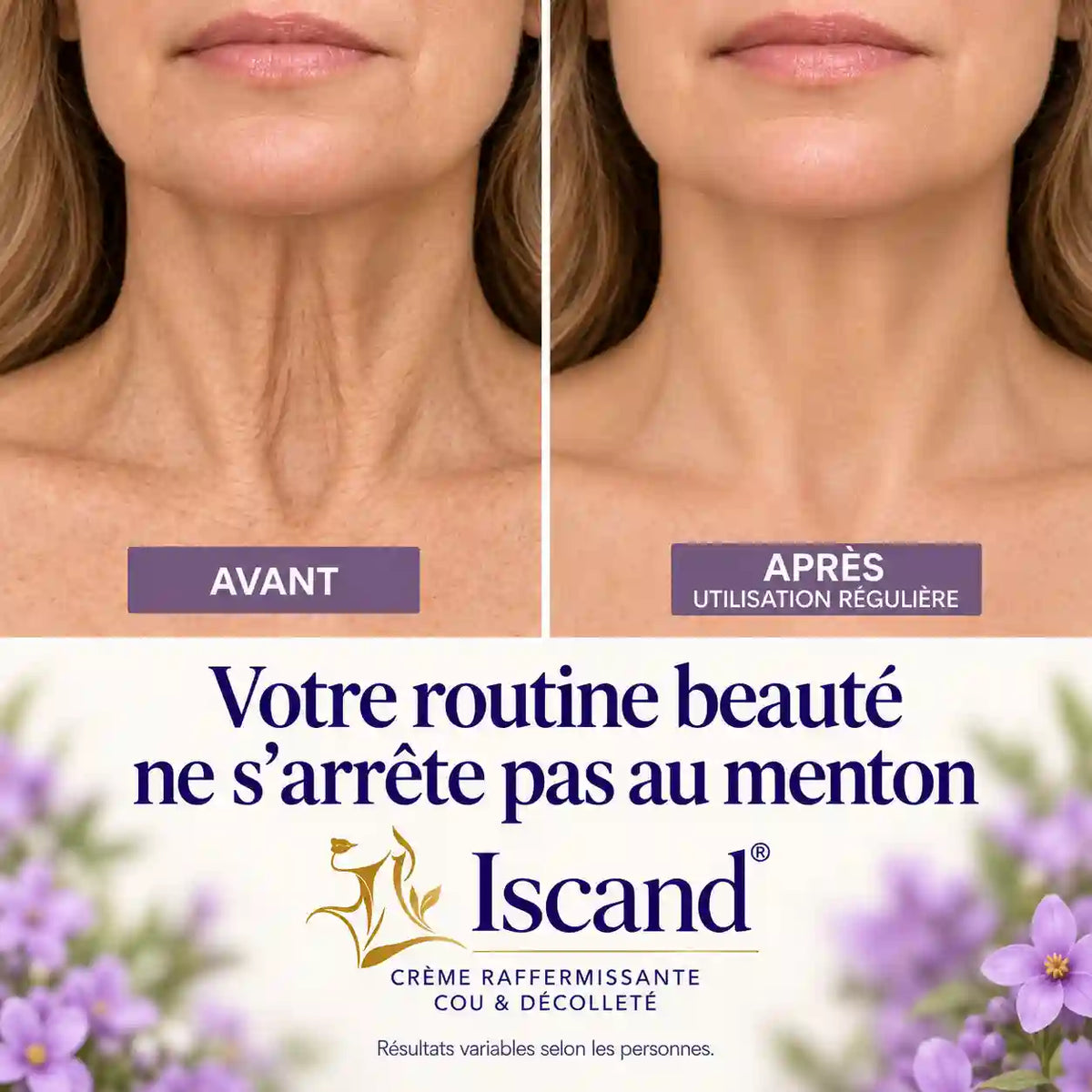 Iscand® Crème Raffermissante