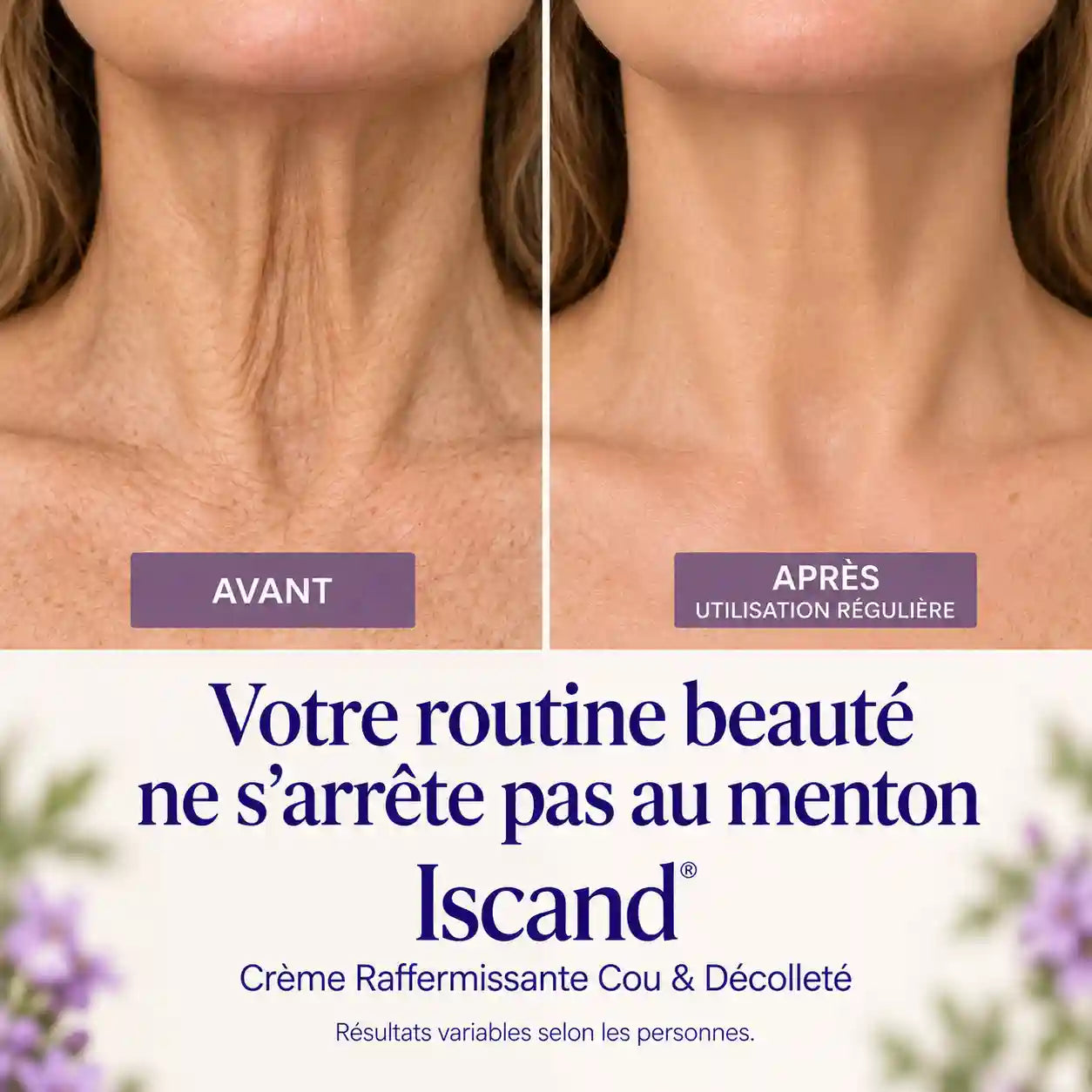 Iscand® Crème Raffermissante