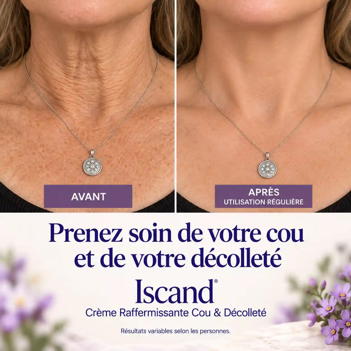 Iscand® Crème Raffermissante