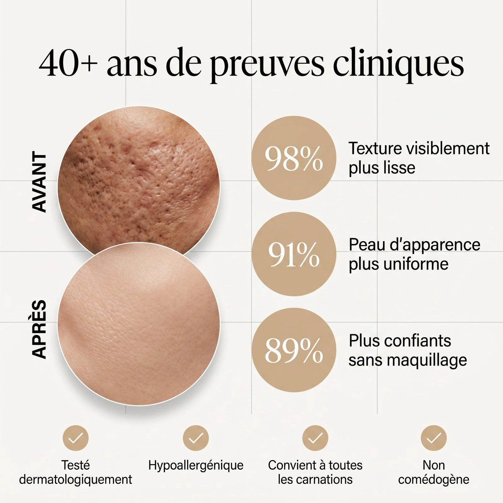 ISCAND™ — Soin clinique pour cicatrices d’acné: