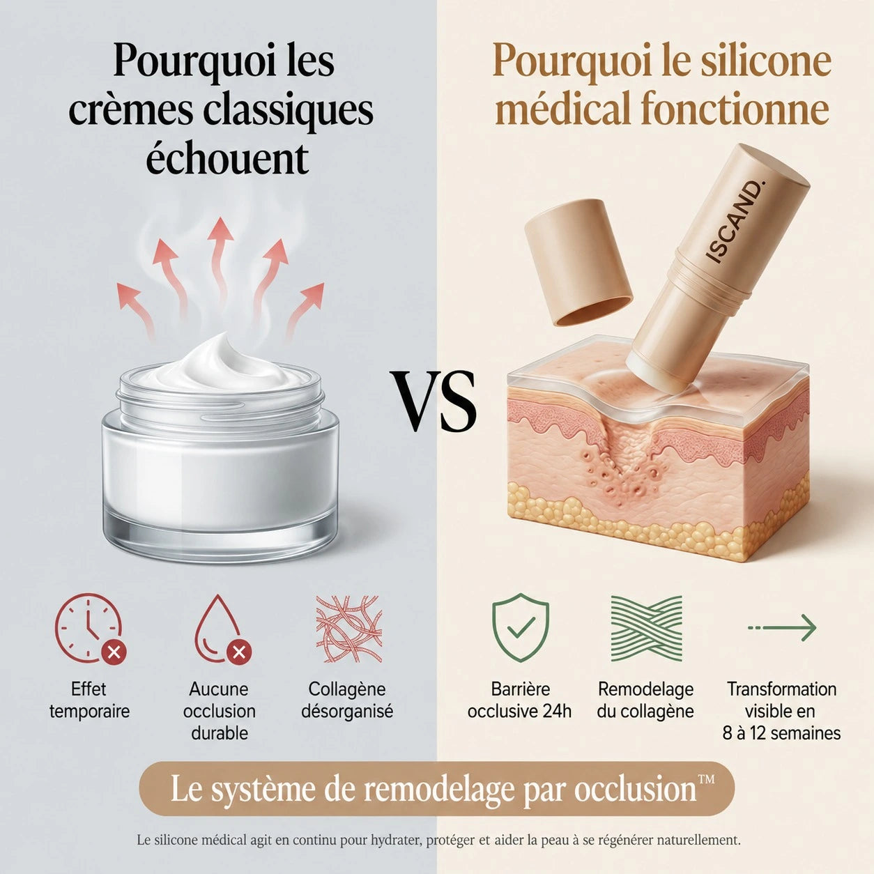 ISCAND™ — Soin clinique pour cicatrices d’acné: