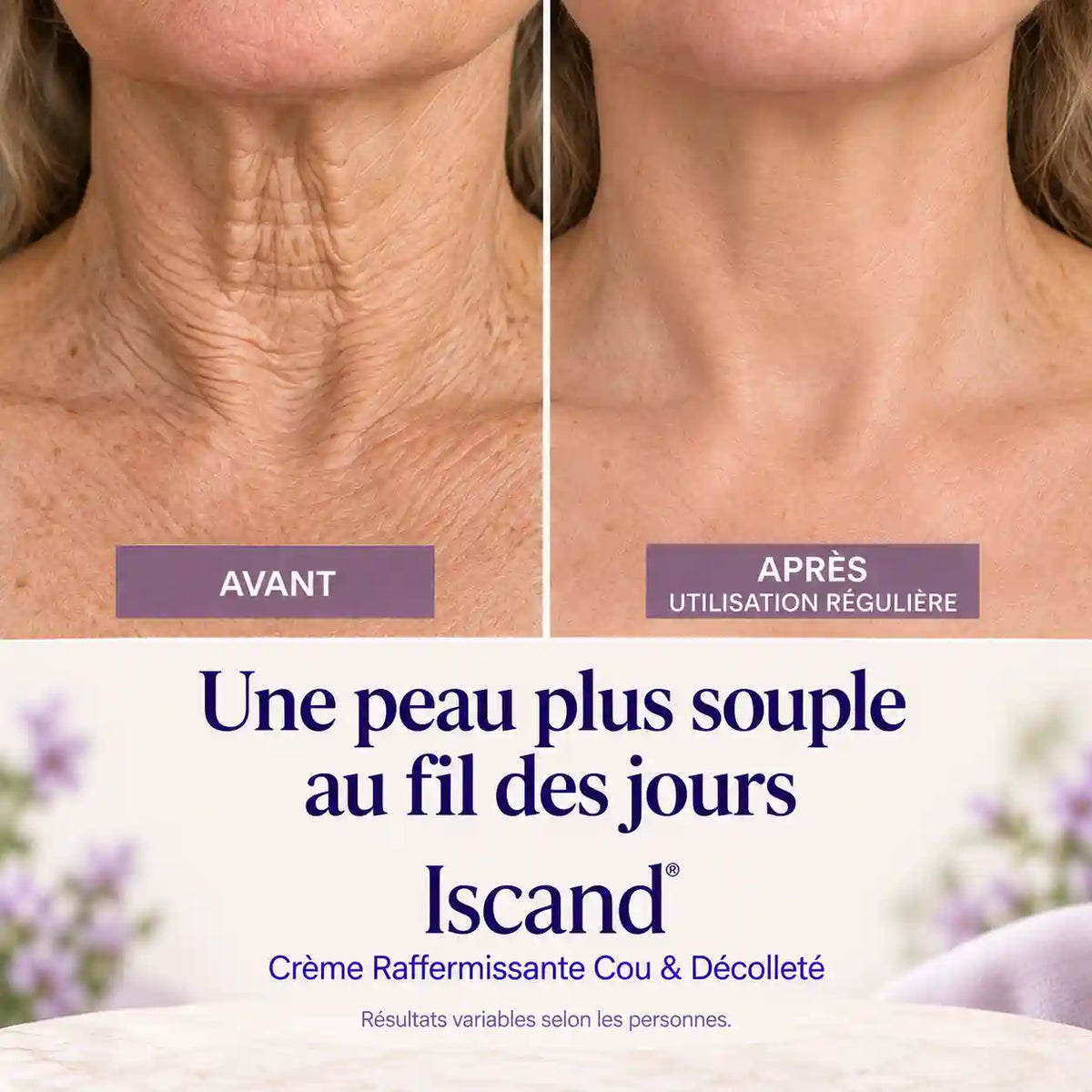Iscand® Crème Raffermissante