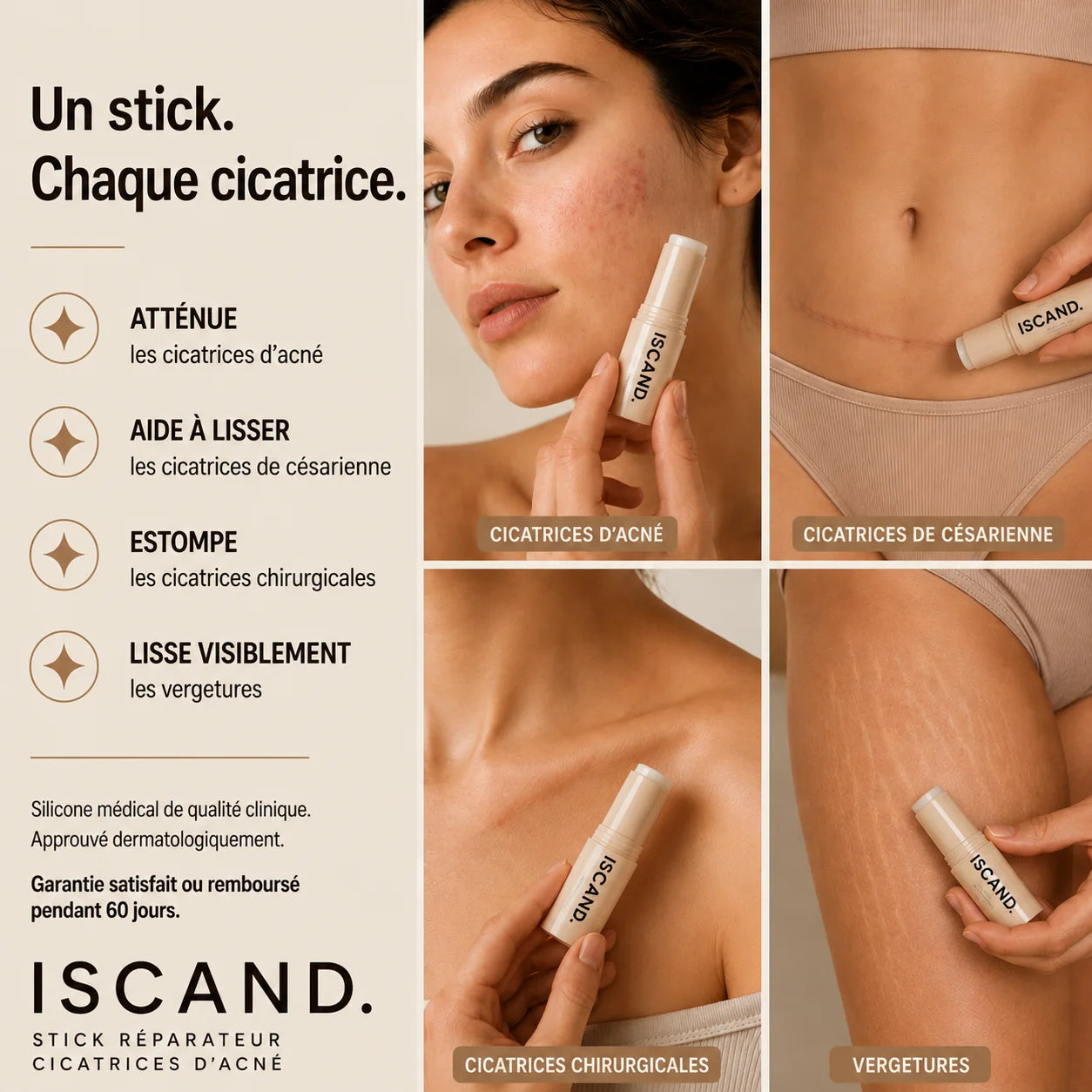ISCAND™ — Soin clinique pour cicatrices d’acné: