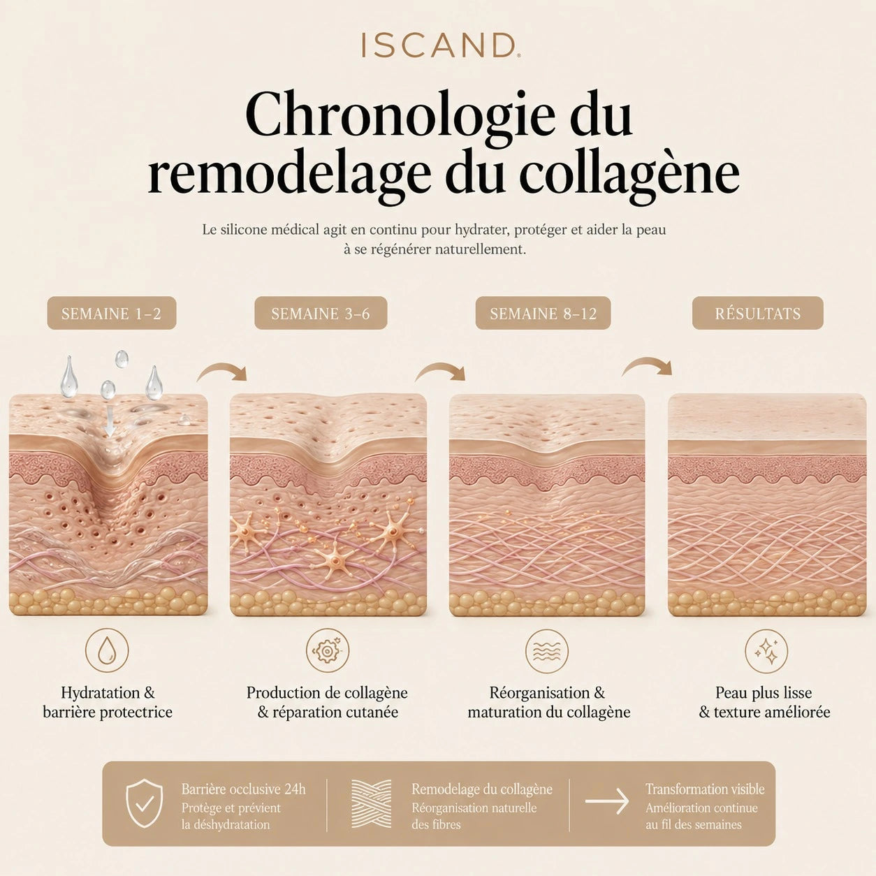 ISCAND™ — Soin clinique pour cicatrices d’acné: