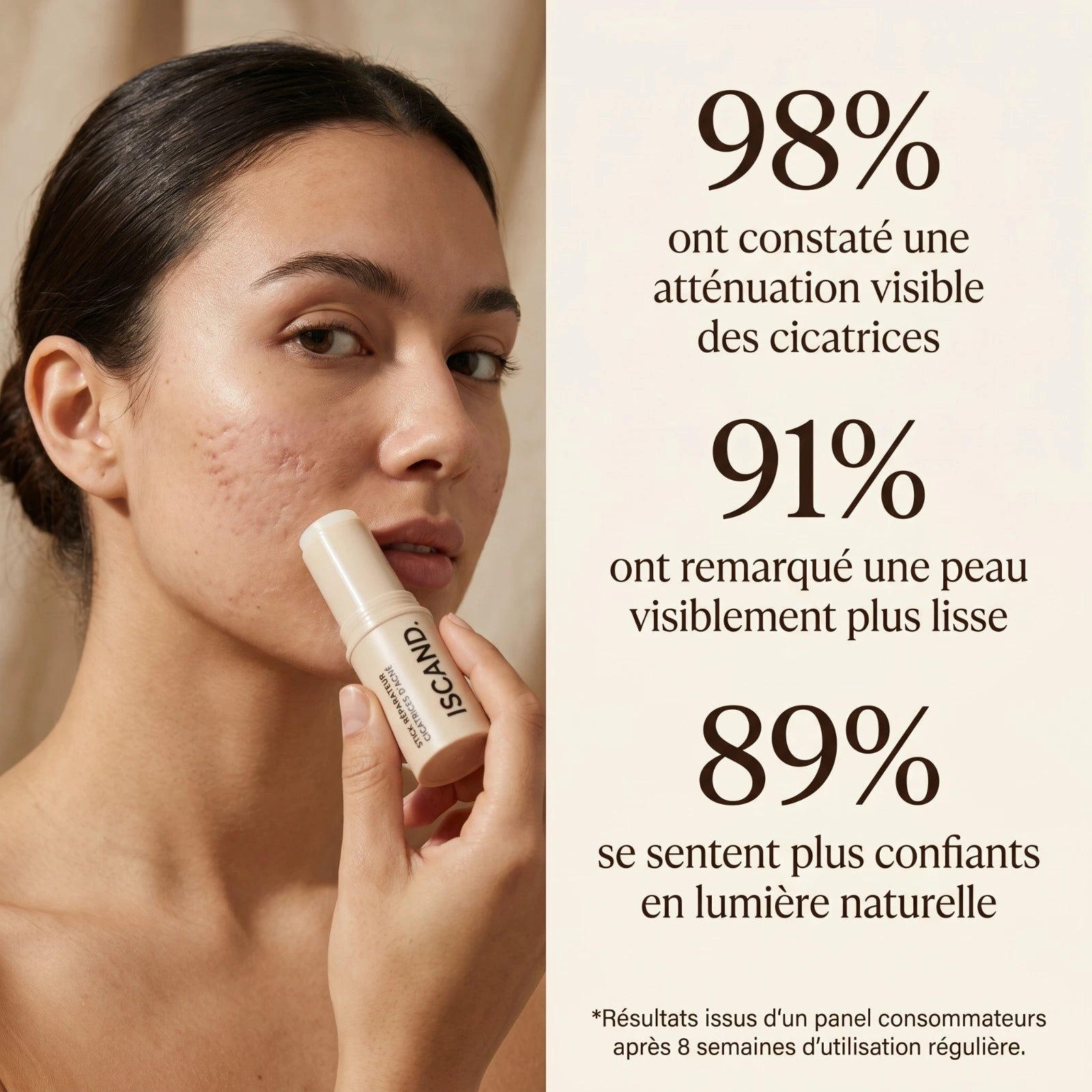 ISCAND™ — Soin clinique pour cicatrices d’acné:
